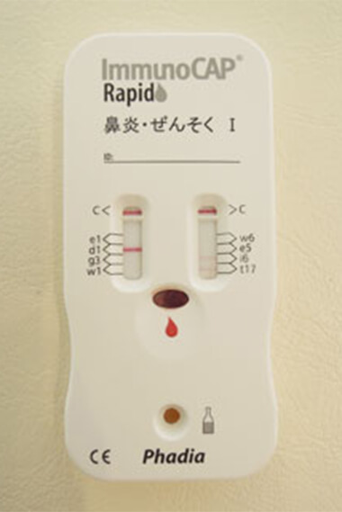 アレルギー迅速検査